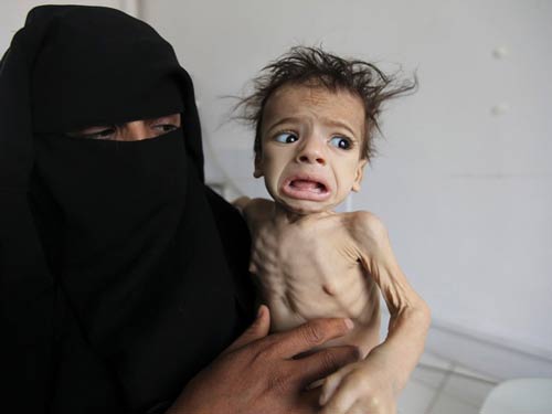 Yemeni starved kid held by his helpless mother