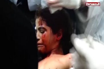 Yemeni victims of Saudi cluster bombs