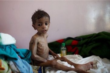 Yemen child