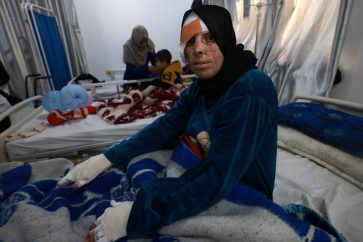 TOPSHOT - Palestinian Nisrine al-Najar receives treatment at a clinic set up by Doctors Without Border (MSF) inside the Rafah Indonesian Field Hospital in Rafah in the southern Gaza Strip, for severe injuries and burns sustained during Israeli bombardment, on March 7, 2024, on the eve of the International Women's Day and amid ongoing battles between Israel and the Hamas movement. (Photo by MOHAMMED ABED / AFP)