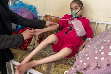 Gaza children famine