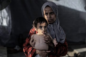According to the Palestinian Health Ministry, 18 people died from starvation in the past 24 hours, including a man with special needs (21-7-2025)